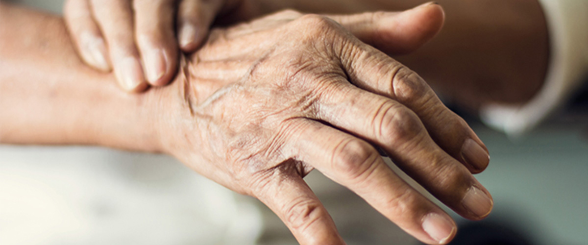 ageing female hands